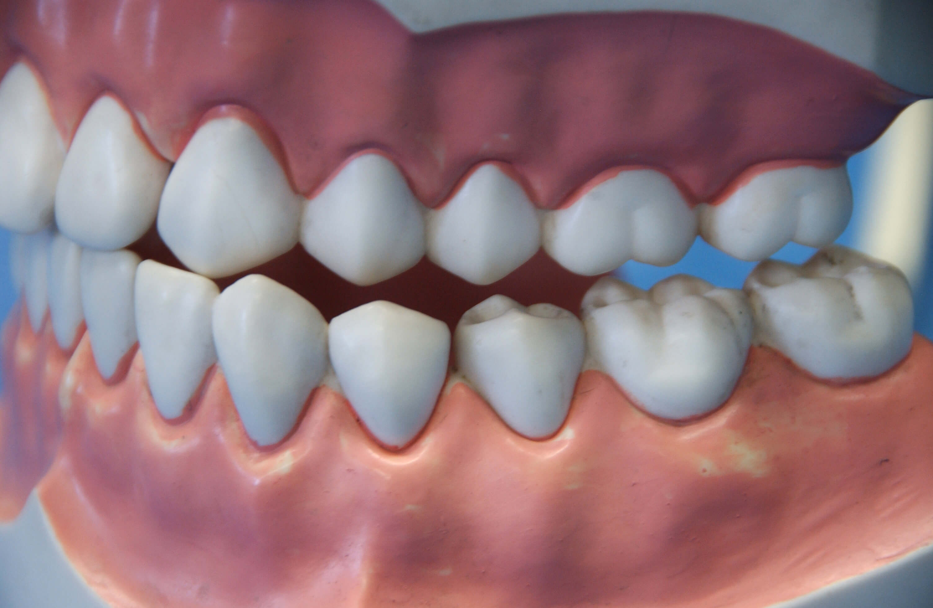 dental-gums