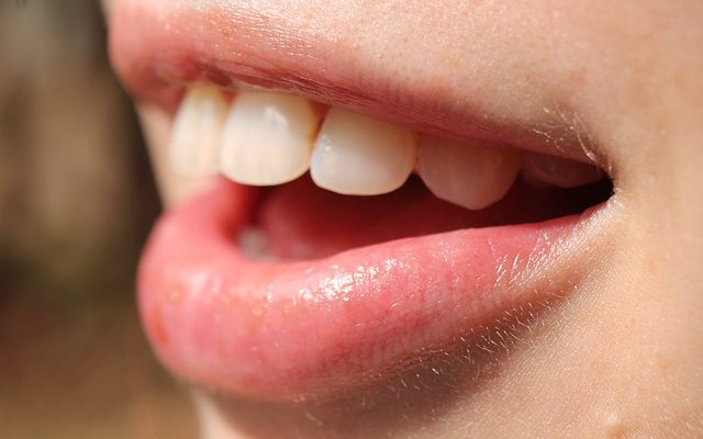 Common Oral Problems